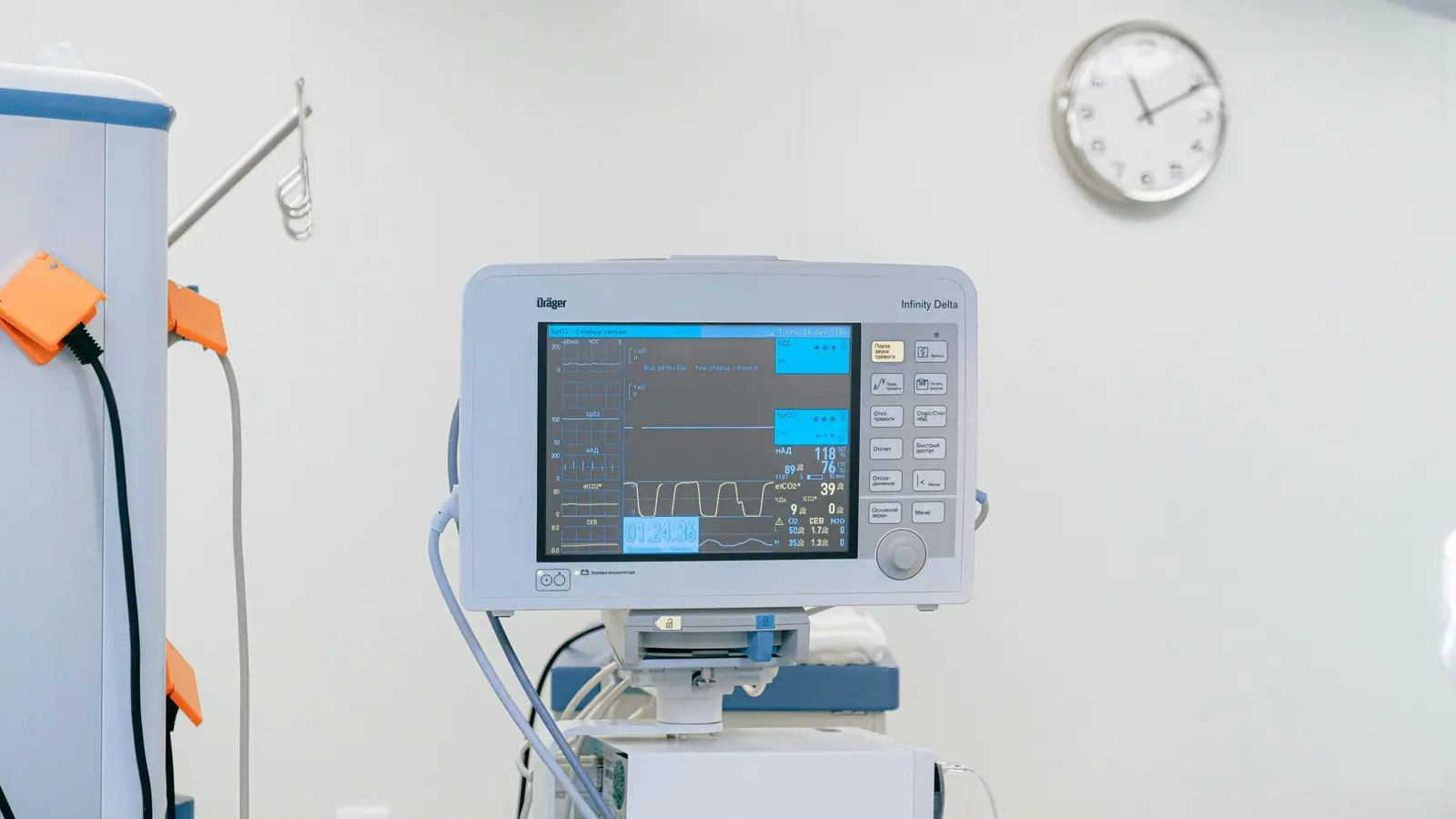 Monitor multiparametrico in un reparto ospedaliero
